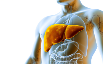 Precision Medicine: Transforming the Management of Complex Liver Diseases